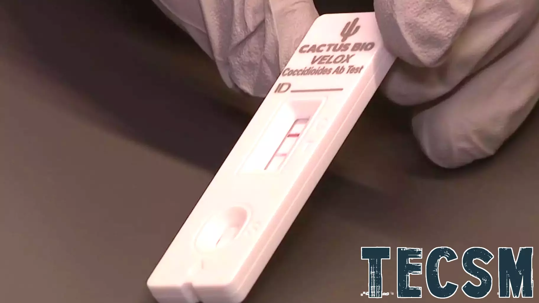 Breakthrough in Valley Fever Detection: Patient Hails New Technology as Transformative