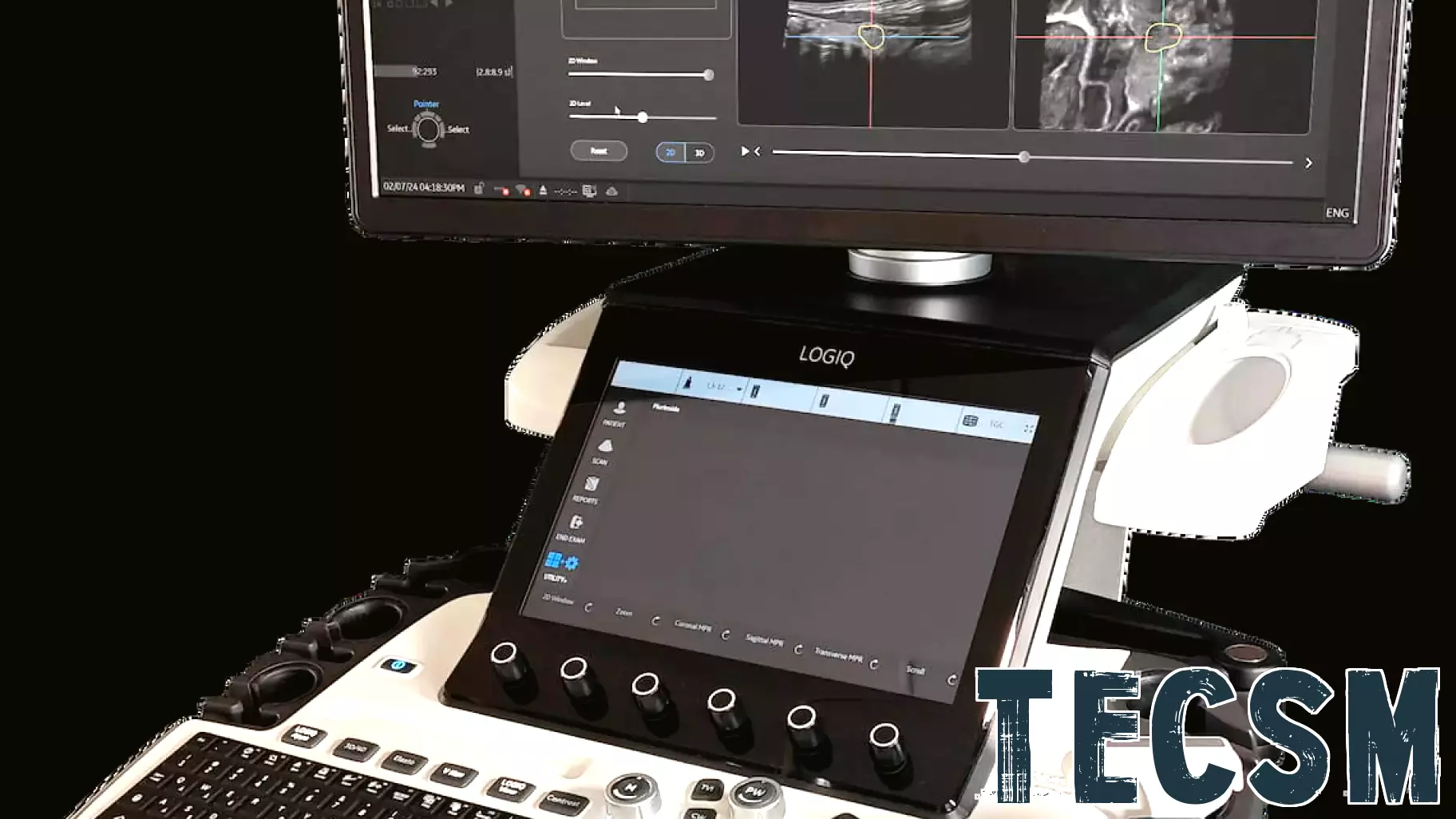 FDA Approves Innovative 3D Ultrasound Technology